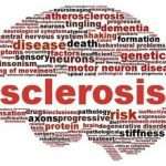 Sclerosis disease