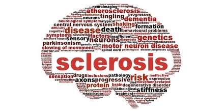 Sclerosis disease